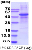Human Matrix Metalloproteinase-28 (MMP-28)