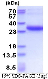 Human Melanoregulin (MREG)
