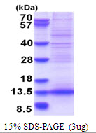 Human MLLT11