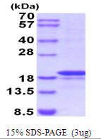 Human Matrix Metalloproteinase-7 (MMP-7)