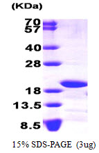 Human NDUFS4