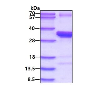 Human NUDT5