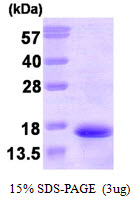 Human Neurokinin B