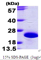 Human NCS1