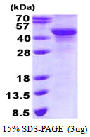 Human NDRG2