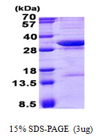 Human Neutral Cholesterol Ester Hydrolase 1 (NCEH1)