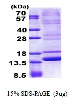 Human Neuromedin-B (NMB)
