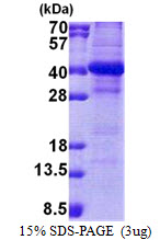 Human NSL1