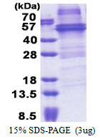 Human RNA-Binding Protein NOB1 (NOB1)