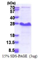 Human NEDD4 Family-Interacting Protein 1 (NDFIP1)