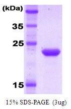 Human Natural Killer-Associated Transcript 1 (NKAT-1)