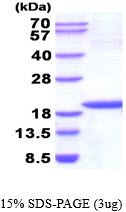 Human NM23A