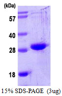 Human Oncostatin-M