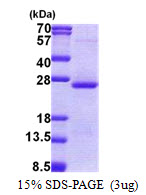 Human Orosomucoid 2
