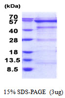 Human Oxidative Stress-Responsive 1 Protein (OXSR1)