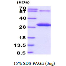 Human PPM1G