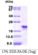 Human Peroxiredoxin-2 (PRDX2)