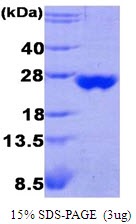 Human Peroxiredoxin-3 (PRDX3)