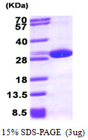 Human Peroxiredoxin-6 (PRDX6)