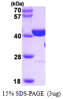 Human PARP1