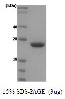 Human Prolactin (PRL)