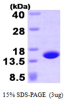 Human Profilin-4