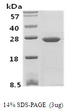 Human Phosphoserine Phosphatase (PSP)
