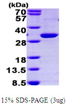 Human PPAR gamma