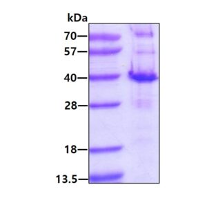 Human PYCR2