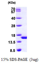 Human Phosphohistidine Phosphatase 1 (PHPT1)