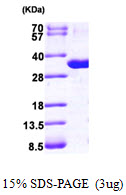Human Purine Nucleoside Phosphorylase (PNP)