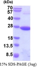 Human Peroxiredoxin-1 (PRDX1)
