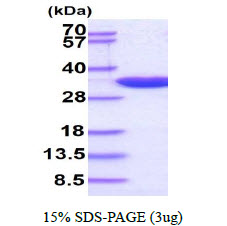 Human PCNA