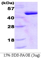 Human Pyruvate Dehydrogenase Kinase Isoform 1 (PDK1)