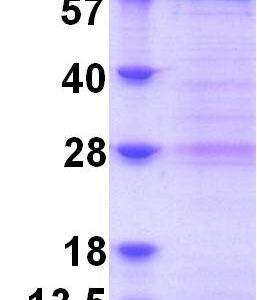 Human p21-Activated Kinase 4 (PAK-4)