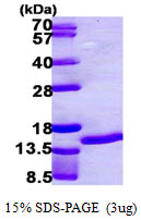 Human Psoriasin