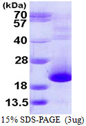 Human PFDN5