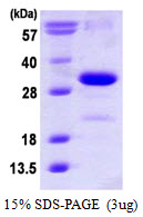 Human P27 KIP1
