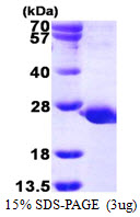 Human PTEN-Like Phosphatase (PTPMT1)