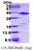 Human PDCL3