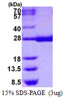 Human Prostaglandin D Synthase (hematopoietic)