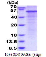 Human Complement Factor P (CFP)
