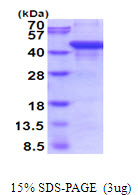 Human Prostatic Acid Phosphatase (ACPP)