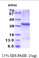 Human Protein-Tyrosine Phosphatase MEG1 (MEG)