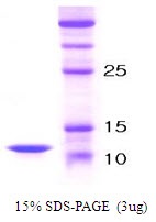 Human Parathyroid Hormone (PTH)