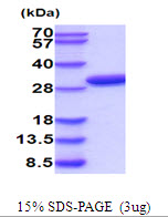 Human PRPS2