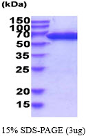Human Phosphoglucomutase-1 (PGM 1 )