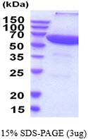 Human PPP2R1A