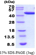 Human PGK1