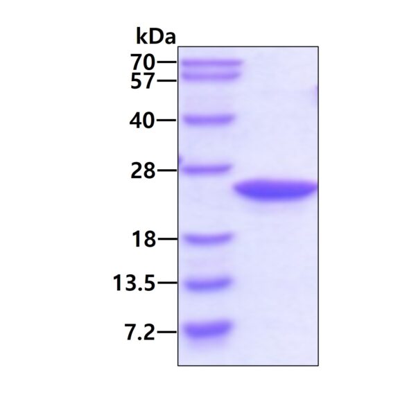 Human Retinol-Binding Protein 4 (RBP4)